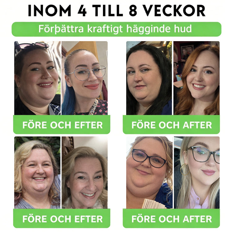 Grattis! Du är vår 500:e kund idag och får ett specialerbjudande: en andra produkt med 50 % rabatt! DOTALE®